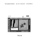 Showing Skin Lesion Information diagram and image