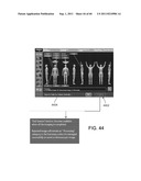 Showing Skin Lesion Information diagram and image