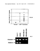 TADG-15: an extracellular serine protease overexpossed in carcinomas diagram and image