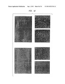 Nanosphere/Microsphere Delivery System for the Treatment of Spinal Cord     Injury diagram and image