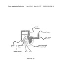 PREVENTING AND/OR TREATING CARDIOVASCULAR DISEASE AND/OR ASSOCIATED HEART     FAILURE diagram and image