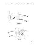 HOT MELT DENTAL MATERIALS AND DEVICES AND METHODS FOR USING THE SAME diagram and image