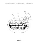 HOT MELT DENTAL MATERIALS AND DEVICES AND METHODS FOR USING THE SAME diagram and image