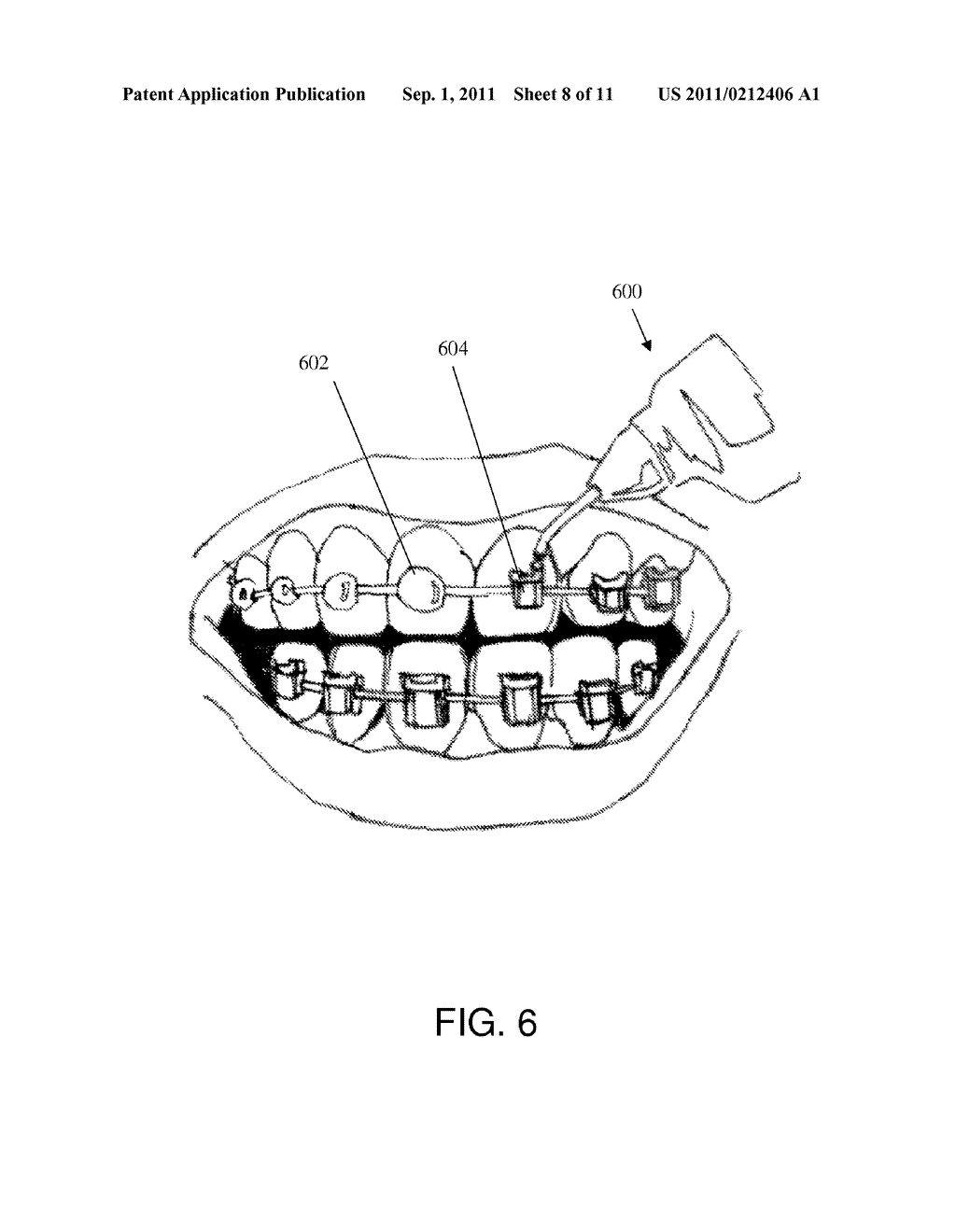 HOT MELT DENTAL MATERIALS AND DEVICES AND METHODS FOR USING THE SAME - diagram, schematic, and image 09