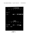 DISTINGUISHING PCA3 MESSENGER RNA SPECIES IN BENIGN AND MALIGNANT PROSTATE     TISSUES diagram and image