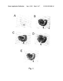 In Vitro Model of Focal Ischemia diagram and image