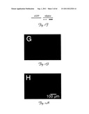 RNA INTERFERENCE SUPPRESSION OF NEURODEGENERATIVE DISEASES AND METHODS OF     USE THEREOF diagram and image