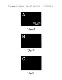 RNA INTERFERENCE SUPPRESSION OF NEURODEGENERATIVE DISEASES AND METHODS OF     USE THEREOF diagram and image