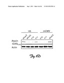 RNA INTERFERENCE SUPPRESSION OF NEURODEGENERATIVE DISEASES AND METHODS OF     USE THEREOF diagram and image