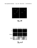 RNA INTERFERENCE SUPPRESSION OF NEURODEGENERATIVE DISEASES AND METHODS OF     USE THEREOF diagram and image