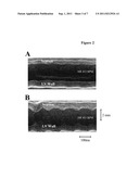 COMPOSITIONS AND METHODS TO TREAT CARDIAC DISEASES diagram and image