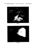 TREATMENT OF NEONATE FOALS WITH MELOXICAM diagram and image