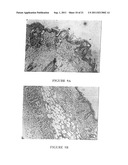 MACROCYCLIC DITERPENES FOR TREATING CONDITIONS ASSOCIATED WITH PROTEIN     KINASE C diagram and image