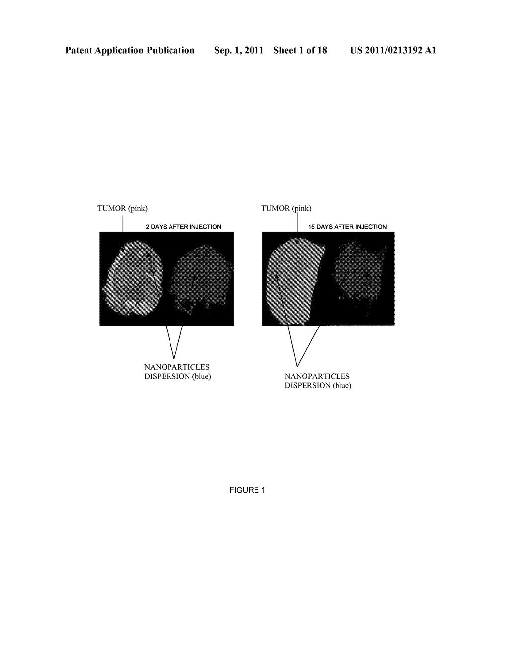 Inorganic Nanoparticles of High Density to Destroy Cells In-Vivo - diagram, schematic, and image 02