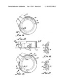 IMPLANTABLE ACCESS PORT DEVICE AND ATTACHMENT SYSTEM diagram and image