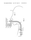 MECHANICALLY DEPLOYABLE TRACHEAL TUBE SENSOR diagram and image