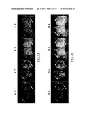 Real-Time Perfusion Imaging and Quantification diagram and image