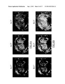 Real-Time Perfusion Imaging and Quantification diagram and image