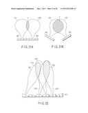 ULTRASONIC TREATMENT APPARATUS diagram and image