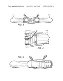 Highly Adjustable Lumbar Brace diagram and image