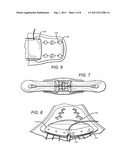 Highly Adjustable Lumbar Brace diagram and image