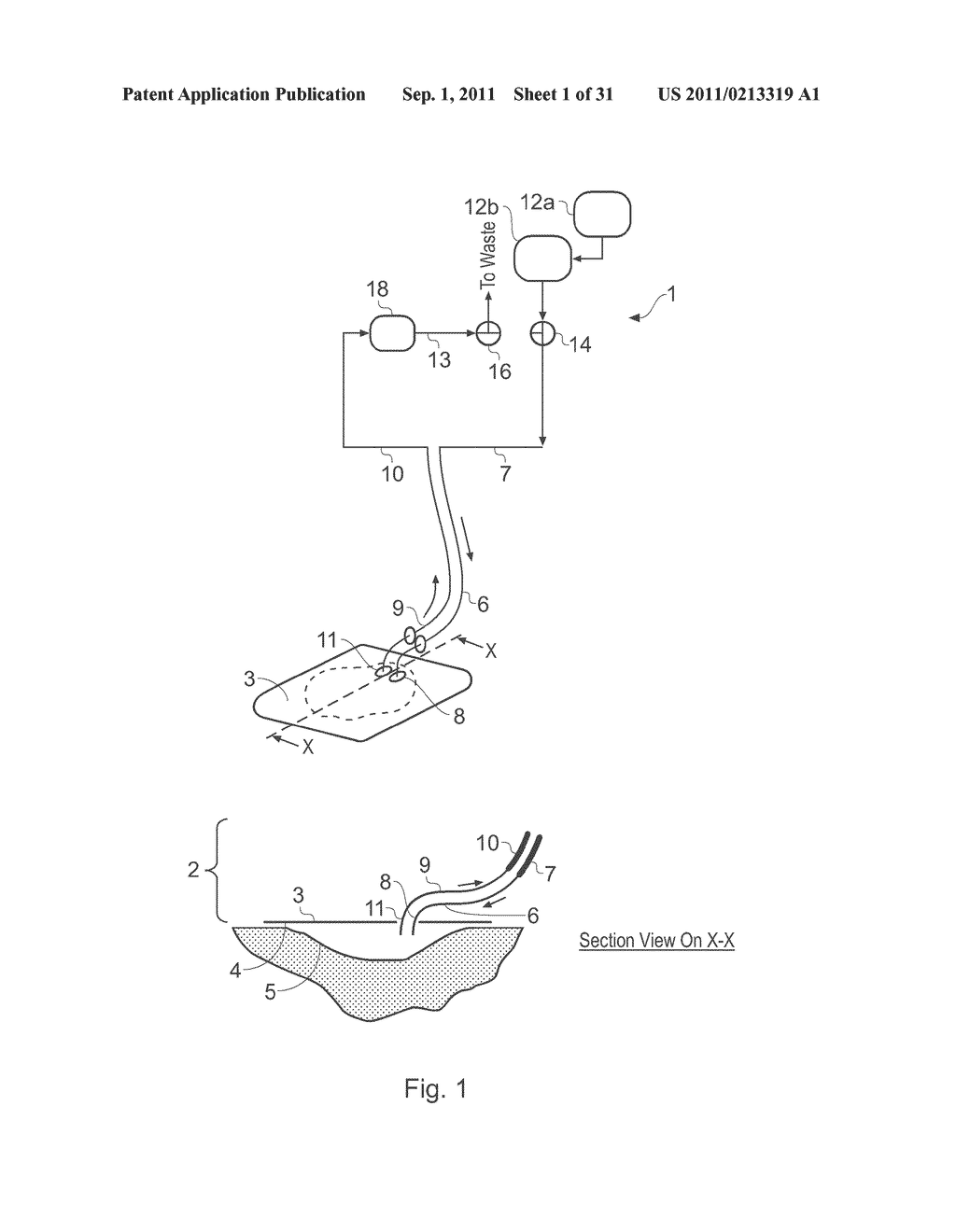 WOUND TREATMENT APPARATUS AND METHOD - diagram, schematic, and image 02