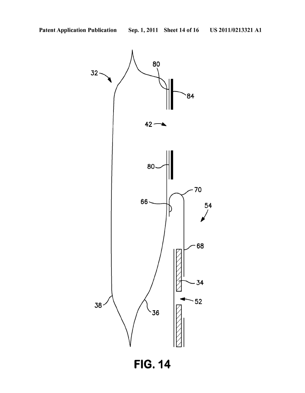 OSTOMY POUCH APPLIANCE - diagram, schematic, and image 15