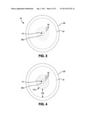 OSTOMY APPLIANCE WITH MOLDABLE ADHESIVE diagram and image