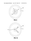 OSTOMY APPLIANCE WITH MOLDABLE ADHESIVE diagram and image