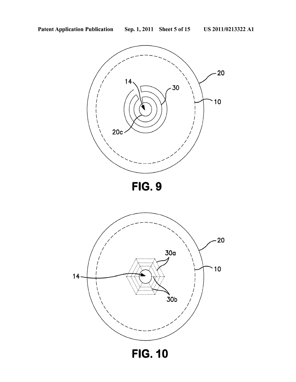 OSTOMY APPLIANCE WITH MOLDABLE ADHESIVE - diagram, schematic, and image 06