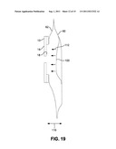 OSTOMY APPLIANCE WITH MOLDABLE ADHESIVE diagram and image