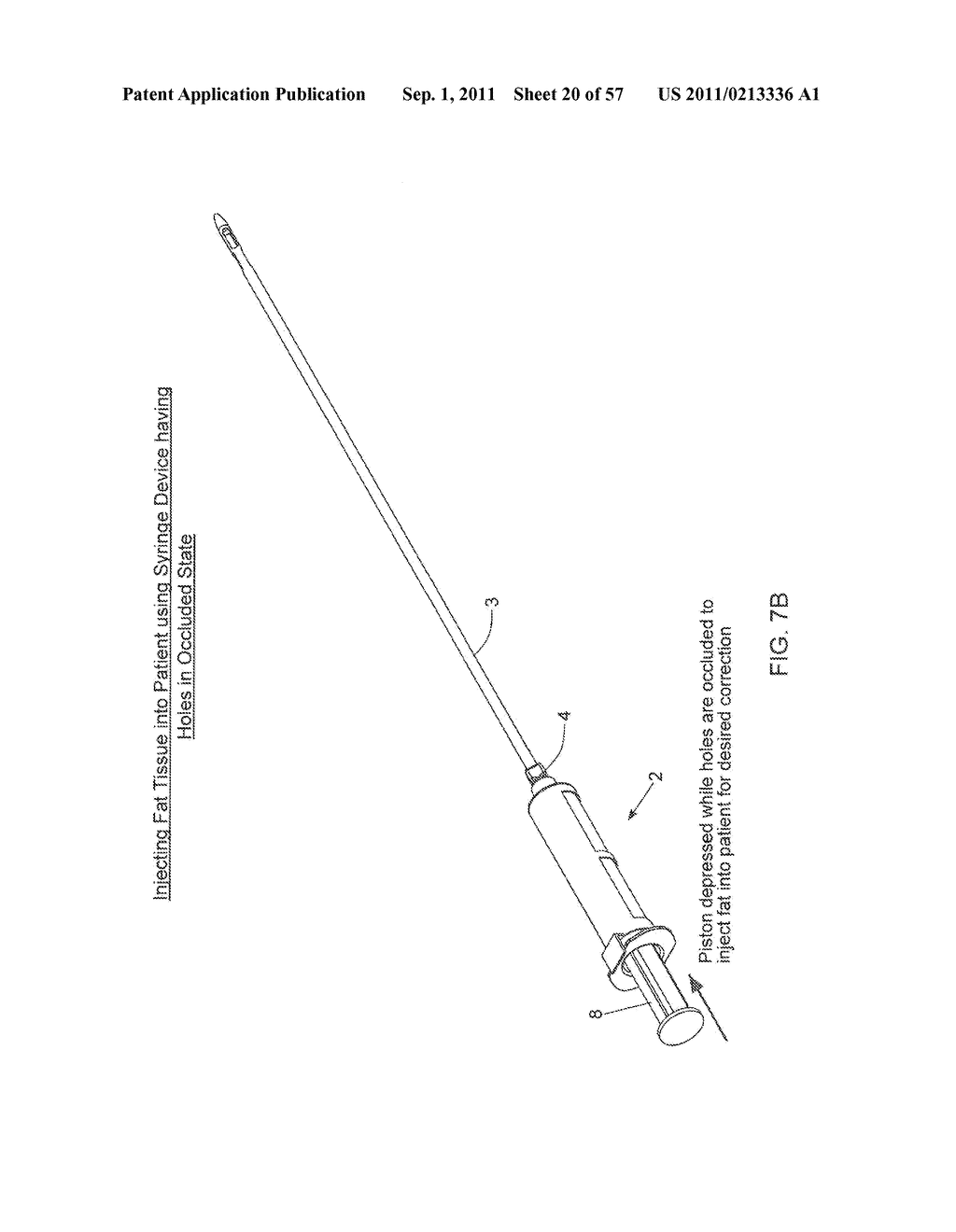 METHOD OF AND APPARATUS FOR SAMPLING, PROCESSING AND COLLECTING TISSUE AND     REINJECTING THE SAME INTO HUMAN PATIENTS - diagram, schematic, and image 21