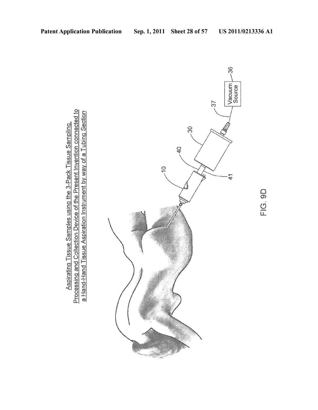 METHOD OF AND APPARATUS FOR SAMPLING, PROCESSING AND COLLECTING TISSUE AND     REINJECTING THE SAME INTO HUMAN PATIENTS - diagram, schematic, and image 29