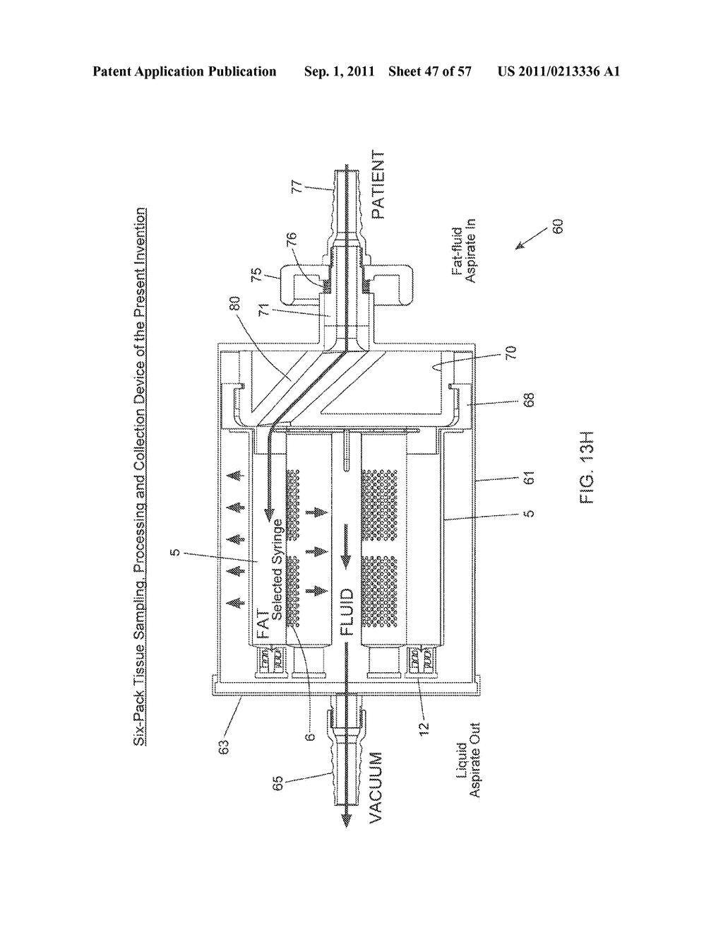 METHOD OF AND APPARATUS FOR SAMPLING, PROCESSING AND COLLECTING TISSUE AND     REINJECTING THE SAME INTO HUMAN PATIENTS - diagram, schematic, and image 48