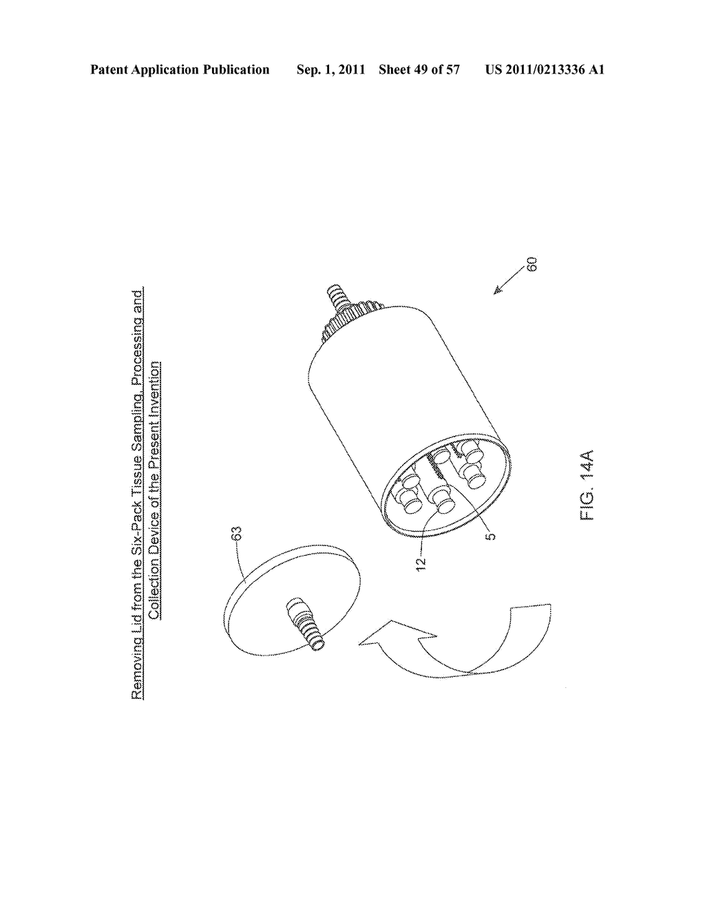 METHOD OF AND APPARATUS FOR SAMPLING, PROCESSING AND COLLECTING TISSUE AND     REINJECTING THE SAME INTO HUMAN PATIENTS - diagram, schematic, and image 50