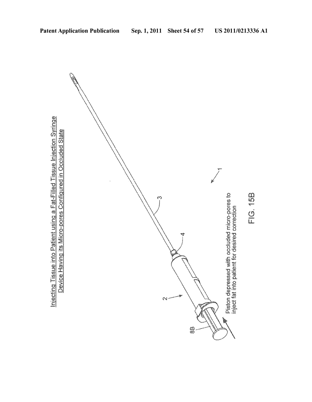 METHOD OF AND APPARATUS FOR SAMPLING, PROCESSING AND COLLECTING TISSUE AND     REINJECTING THE SAME INTO HUMAN PATIENTS - diagram, schematic, and image 55