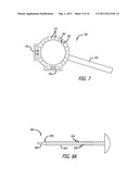 Real-time Virtual Indicium Apparatus and Methods for Guiding an Implant     into an Eye diagram and image