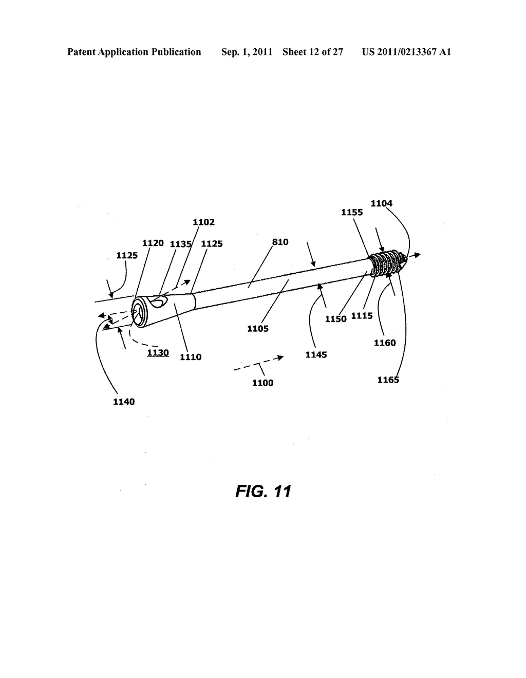 INTRAMEDULLARY FIXATION SCREW, A FIXATION SYSTEM, AND METHOD OF FIXATION     OF THE SUBTALAR JOINT - diagram, schematic, and image 13