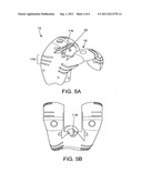 DISTAL FEMORAL TRIAL WITH REMOVABLE CUTTING GUIDE diagram and image