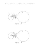 DELIVERY SYSTEMS AND METHODS FOR GASTRIC REDUCTION diagram and image