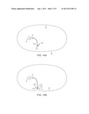 DELIVERY SYSTEMS AND METHODS FOR GASTRIC REDUCTION diagram and image