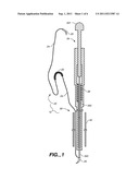 Minimally Invasive Valve Repair Procedure and Apparatus diagram and image