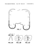 Minimally Invasive Valve Repair Procedure and Apparatus diagram and image