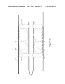 Embolectomy Cathether diagram and image