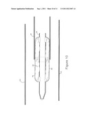 Embolectomy Cathether diagram and image