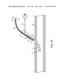 METHOD FOR VESSEL ACCESS CLOSURE diagram and image