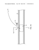 METHOD FOR VESSEL ACCESS CLOSURE diagram and image