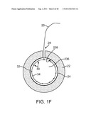 METHOD FOR VESSEL ACCESS CLOSURE diagram and image