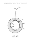 METHOD FOR VESSEL ACCESS CLOSURE diagram and image