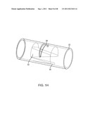 METHOD FOR VESSEL ACCESS CLOSURE diagram and image